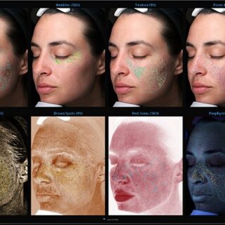 Visia skin analysis scans