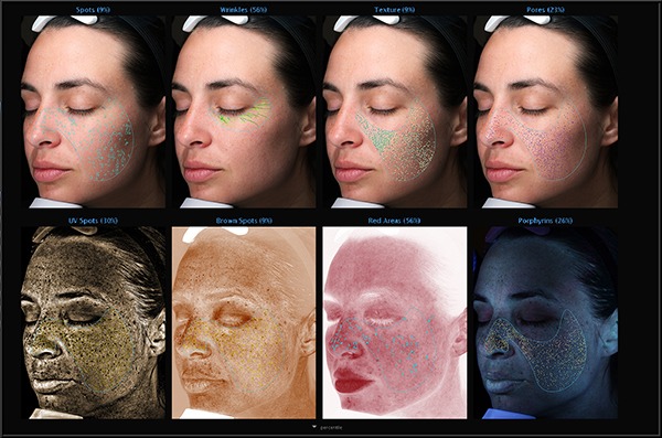 Visia skin analysis scans